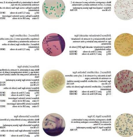 Cu L Es El Crecimiento De Las Bacterias En Los Medios De Cultivo