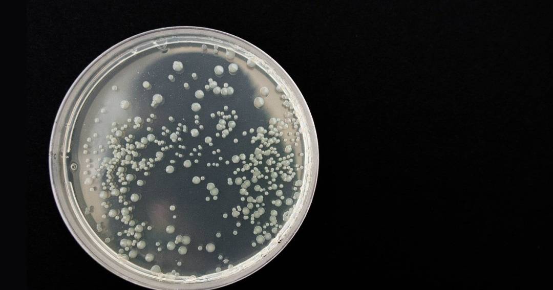 cuales son los medios liquidos para el cultivo de bacterias