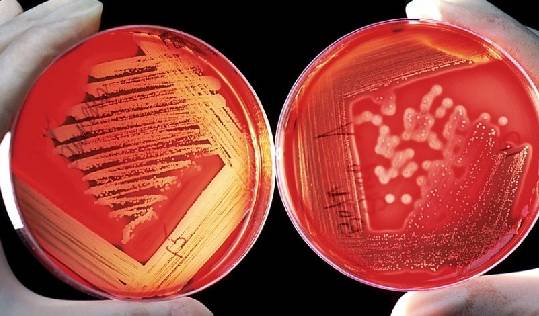 cuales son los tipos de siembra de cultivos en microbiologia