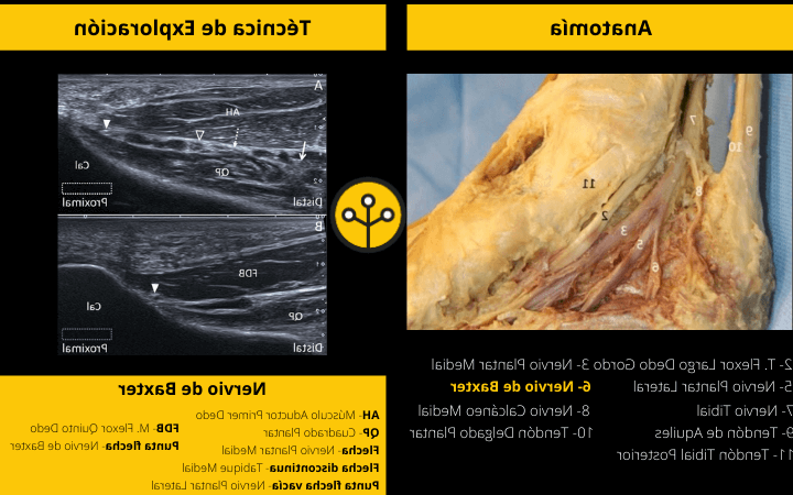 tienes dolor en el nervio plantar medial del dedo gordo del pie